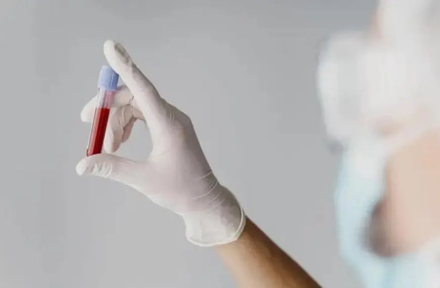 Гепатит А Київ — медичні служби підтвердили десятки випадків в Отрадному