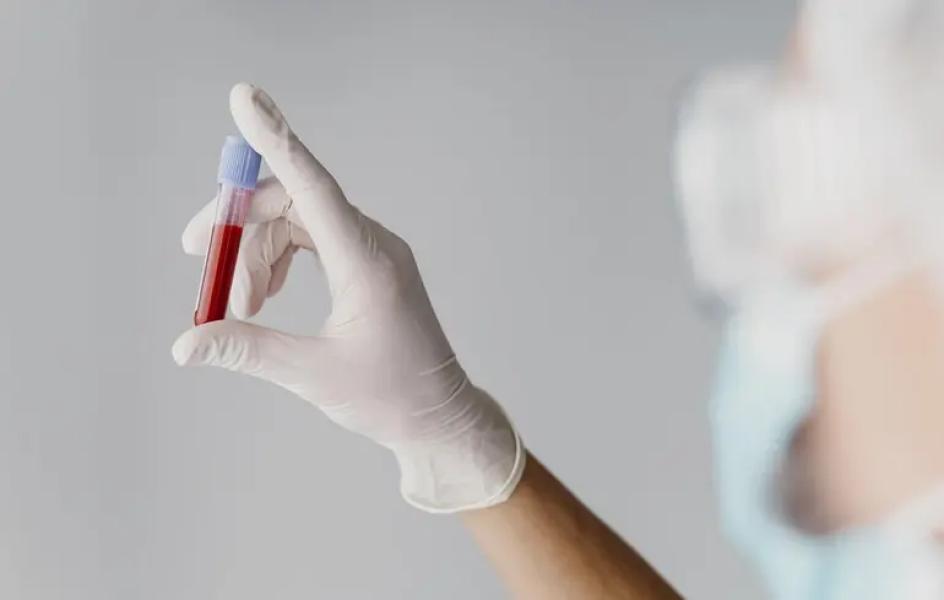 Спалах гепатиту А в Києві: підтверджено 76 випадків захворювання