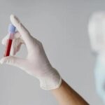 Гепатит А Київ — медичні служби підтвердили десятки випадків в…