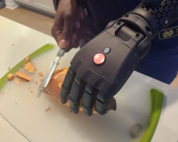 Даніель Грін використовує свою руку Hero RGD™ від Open Bionics з індивідуальними чохлами, створеними у партнерстві з Call of Duty Endowment. Індивідуальна біонічна рука Даніель була офіційно представлена на Call of Duty NEXT 2025 у Лас-Вегасі 30 вересня. Жінка-ветеранка армії США, яка мало не загинула внаслідок вибуху гранати в Іраку, стала першою у світі, якій було встановлено нову біонічну руку «героя», натхненну Call of Duty. Даніель Грін втратила ліву руку під час служби в Багдаді 20 років тому і з того часу бореться з повсякденними завданнями. Але тепер, вперше у світі, 48-річна жінка каже, що хоче надихнути колег-ветеранів та людей з ампутованими кінцівками, і нарешті відчуває себе «повноцінною» після того, як їй встановили Hero RGD. Міцна нова кінцівка, яку описують як найміцнішу біонічну руку у світі, була розроблена британською робототехнічною фірмою Open Bionics з дизайном, натхненним грою Call of Duty: Black Ops 7. Фото опубліковано 10.01.2025.