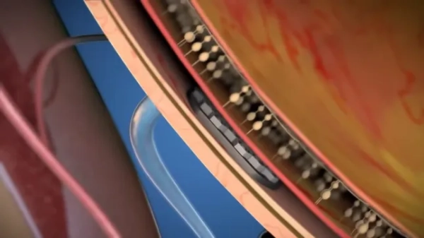 Конкурент Ілона Маска створює революційний очний чіп, який вперше у світі відновлює зір