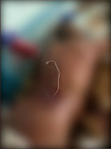 Снаряд потрапив у стегно, але не вибухнув: ексклюзивні подробиці порятунку бійця медичними працівниками 8