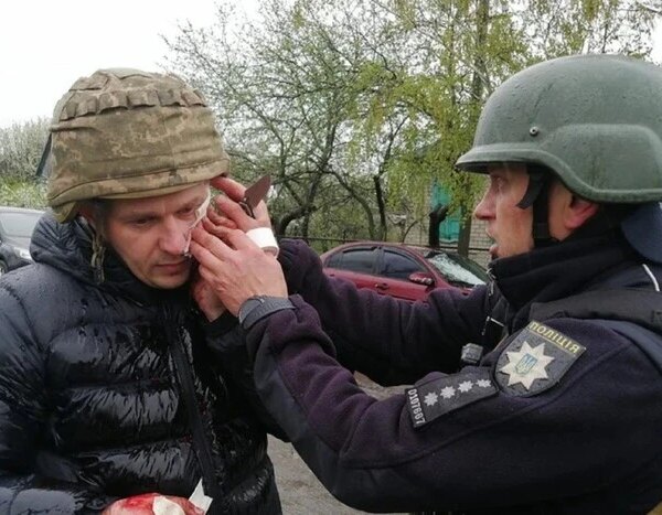 ПОРТАЛ новин 98 На Дніпропетровщині чоловік під час затримання кинув гранату у правоохоронців: є постраждалі
