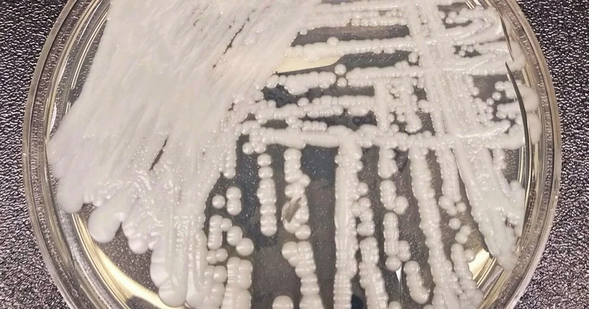 Штам Candida auris. Фото: Бібліотека зображень у сфері громадського здоров’я (PHIL) Центрів з контролю та профілактики захворювань (CDC) під ідентифікаційним номером #21796 Штам Candida auris. Фото: Бібліотека зображень у сфері громадського здоров’я (PHIL) Центрів з контролю та профілактики захворювань (CDC) під ідентифікаційним номером #21796