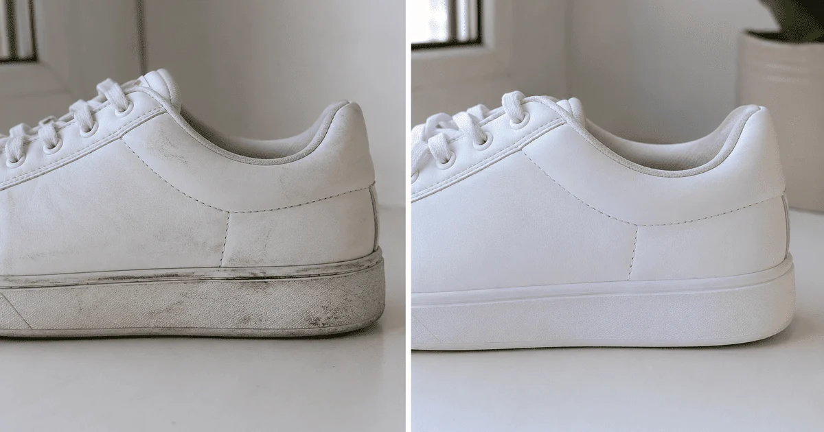 How to quickly whiten the sole How to quickly whiten the sole