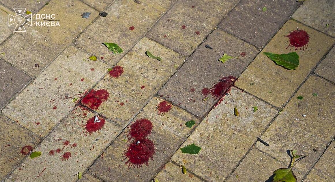 Напад Росії на Київську область призвів до загибелі двох дітей – дворічної та чотирнадцятирічної дівчат ➜ ZMINA 2 Напад Росії на Київську область призвів до загибелі двох дітей – дворічної та чотирнадцятирічної дівчат ➜ ZMINA 2
