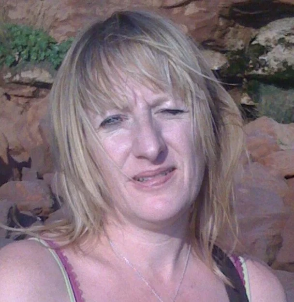 Jane Hardman before losing her nose / © needtoknow.co.uk