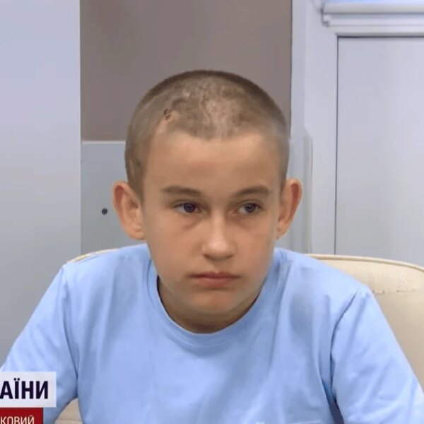 Бачили, що били по дитині”: 13-річного Родіона атакував безпілотник, під час евакуації окупанти намагалися добити юнака