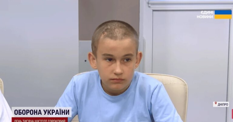 Бачили, що били по дитині": 13-річного Родіона атакував безпілотник, під час евакуації окупанти намагалися добити юнака 6 Бачили, що били по дитині": 13-річного Родіона атакував безпілотник, під час евакуації окупанти намагалися добити юнака 6