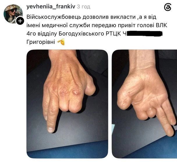 Військово-лікарська комісія на Харківщині визнала чоловіка, якому бракує трьох пальців на руці, придатним до військової служби, про що повідомляють соціальні мережі. 7