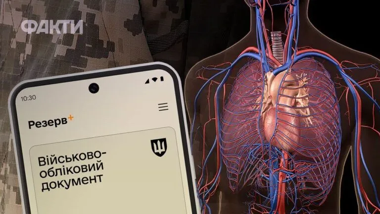 Фото до статті